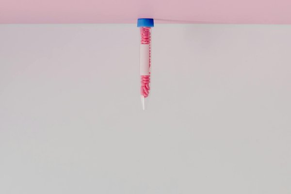 Soins orthodontiques à nanterre : un sourire sans gêne